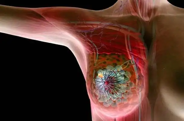 Moterų žinios apie krūties vėžį bei jo prevenciją.