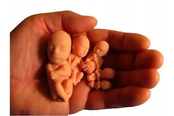 Vaiko gyvybė versus moters teisė į abortą. Ar tikrai reikia rinktis būtinai vieną iš jų? 