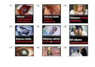 NERŪKANTIEMS NEREIKIA MATYTI RŪKALŲ PAKUOČIŲ SU BAISIOMIS NUOTRAUKOMIS