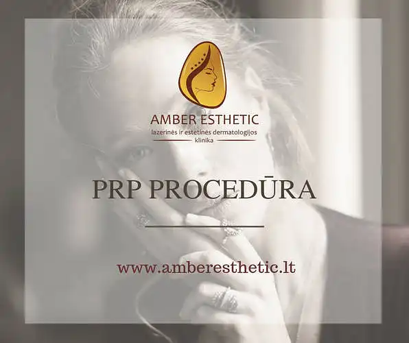 Ar Jums yra tekę išbandyti PRP procedūrą?