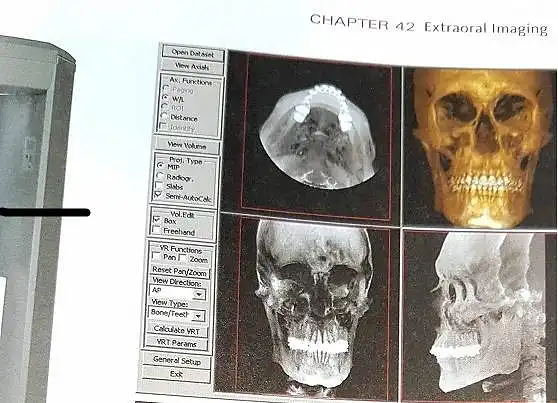 8. Ar žinote kas yra 3D tomografinė nuotrauka? Ji pavaizduota paveikslėlyje.  (pasirinkite vieną atsakymo variantą)