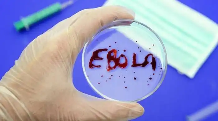SMK studentų požiūris į Ebolos virusą