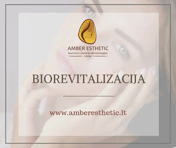 Ar Jums yra tekę išbandyti biorevitalizaciją? 