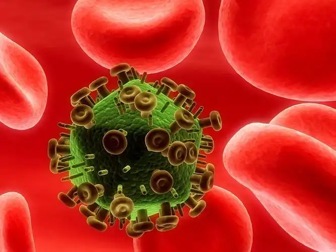 Gydytojų odontologų požiūris į ŽIV infekuotų asmenų gydymą