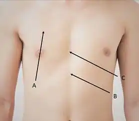 Kurioje vietoje spaudžiama krūtinė atliekant išorinį širdies masažą?