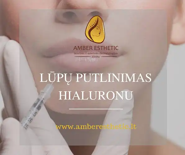 ,,Amber Esthetic" estetinės dermatologijos klinika klausia: ar teko išbandyti lūpų putlinimą hialuronu?