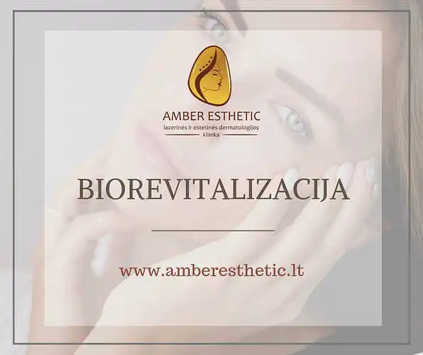 ,,Amber Esthetic" klinika klausia: kaip vertinate biorevitalizacijos procedūrą?